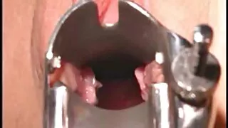 OSURUK ABANOZ anal porno anal GENÇ EV YAPIMI BECERİYOR SEKSİ GAS İÇİN İBADET GÖT